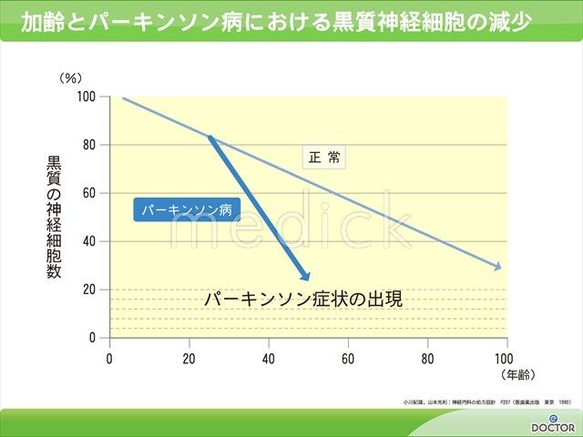 パーキンソン病と「水素ガス吸引療法」,「Ph10点滴療法」,「プラズマ療法」
